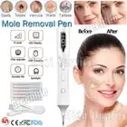 LCD Laser Skin Tag Freckle Wart Dot Mole Remove Pen Dark Spot Tattoo Removal USB
