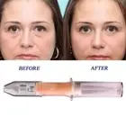 2 Minutes To Remove Eye Bags Lasting Effect Hot Cream Eye ~us Removal V7Z7