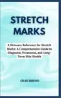 Stretch Marks: A Skincare Reference for Stretch Marks: A Comprehensive Guide to