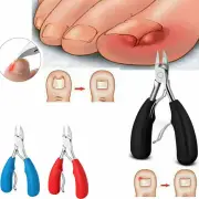 Nail Clippers Scissors Fungus Ingrown Chiropody Podiatry Plier Thick Toenail Toe