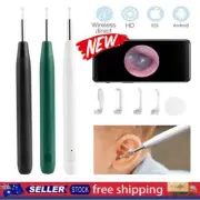 Wireless Ear Wax Remover Cleaner Tool Endoscope Spoon Pick 1080P HD Camera CE
