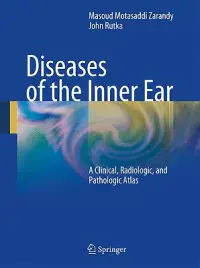 在飛比找博客來優惠-Diseases of the Inner Ear: A C