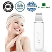 Limpiador De Poros Y Puntos Negros Facial Profesional Exfoliante 4 Modos TOP