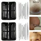 9x Blackhead Remover Tool Kit Spot Acne Pimple Comedone Extractor Popper Come xg