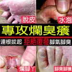 💥香港腳噴劑止癢治腳氣去腳臭腳氣剋星脫皮水泡足癬腳氣噴劑除腳臭噴霧腳汗腳底水泡足爽腳臭粉腳底發白爛腳丫抑真菌💥