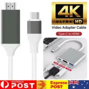 2M 4K USB C to HDMI Cable Type Adapter For iPhone 16 MacBook iPad Android Tab Au