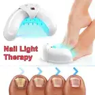 Nail Fungus Laser Treatment Device for Multiple Toenail Toes Nail Light Therapy