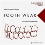 <麗文校園購>TOOTH WEAR: INTERCEPTIVE TREATMENT APPROACH WITH MINIMALLY INVASIVE PROTOCOLS DIETSCHI 9781786981158