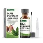 Nail Treatment Fungus Anti Fungal Toe Removal Care Solution Deep Cleaningδδ