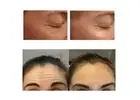 1 Liter Palmitoyl Tripeptide-38 Forehead Crow's Feet Wrinkle Reduce Peptide