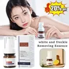 Whiting And Freckle Removing Serum Cream Dark Spot Rmover Freckle Cream Serum