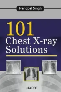 在飛比找博客來優惠-101 Chest X-Ray Solutions