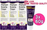 3x 60g Hopes Relief Cream Premium Natural Eczema Psoriasis Dermatitis Hope's