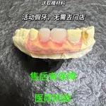 訂製缺牙牙套隱形義齒門牙仿真假牙鋼圈義齒美觀種植臨時牙